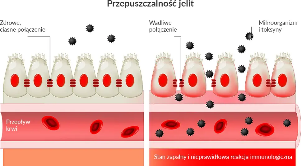 Przepuszczalność jelit